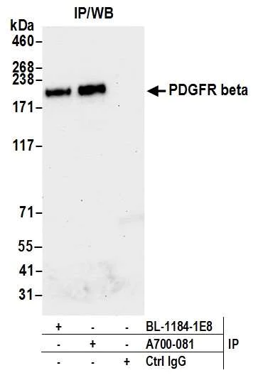 Immunoprecipitation - Anti-PDGFR beta antibody [BLR081G] - BSA free (AB314096)
