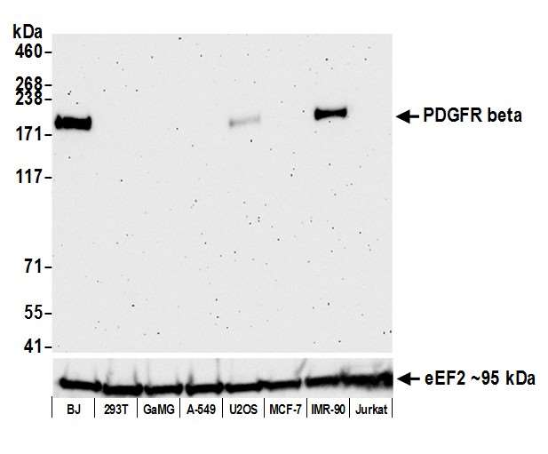 Western blot - Anti-PDGFR beta antibody [BLR081G] - BSA free (AB314096), expandable thumbnail