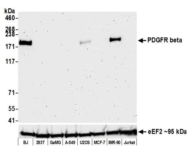 Western blot - Anti-PDGFR beta antibody [BLR081G] - BSA free (AB314096)