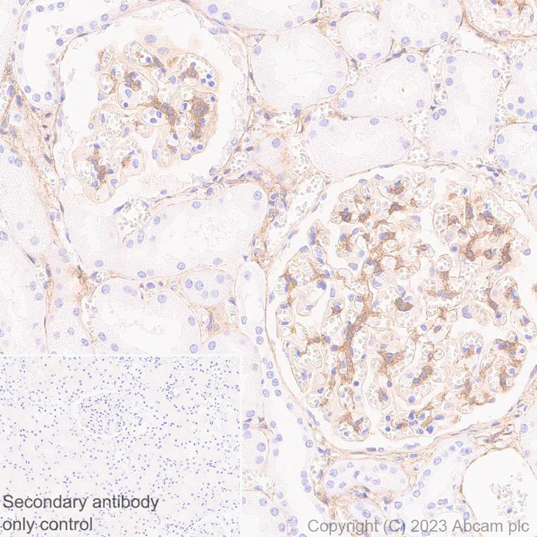 Immunohistochemistry (Formalin/PFA-fixed paraffin-embedded sections) - Anti-PDGFR beta antibody [EPR26830-84] (AB313777)