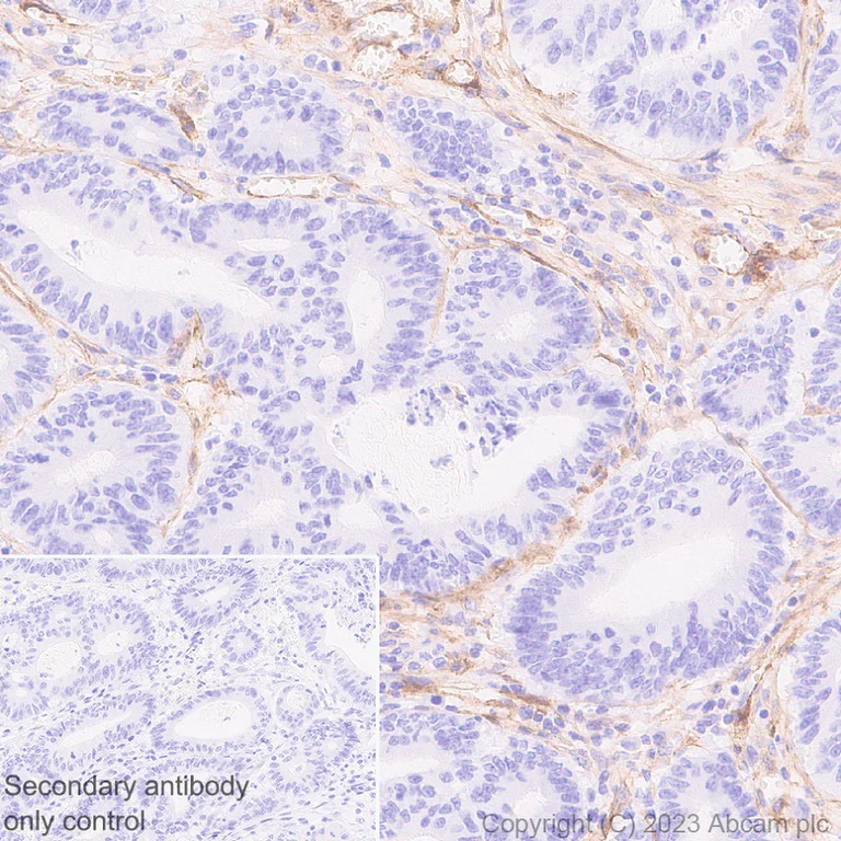 Immunohistochemistry (Formalin/PFA-fixed paraffin-embedded sections) - Anti-PDGFR beta antibody [EPR26830-84] (AB313777)