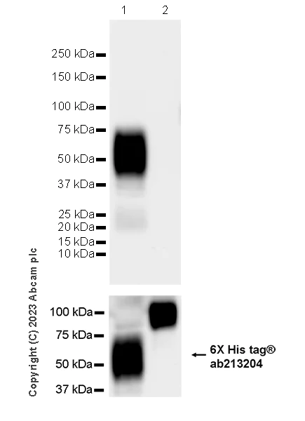 Western blot - Anti-PDGFR beta antibody [EPR26830-84] (AB313777)
