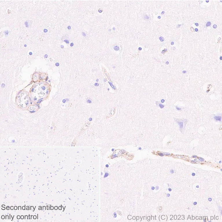 Immunohistochemistry (Formalin/PFA-fixed paraffin-embedded sections) - Anti-PDGFR beta antibody [EPR26830-84] - BSA and Azide free (AB313778)