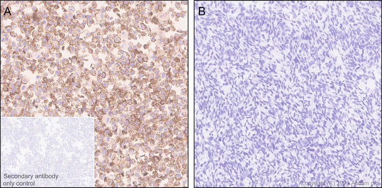 Immunohistochemistry (Formalin/PFA-fixed paraffin-embedded sections) - Anti-PDGFR beta antibody [EPR26830-84] - BSA and Azide free (AB313778)