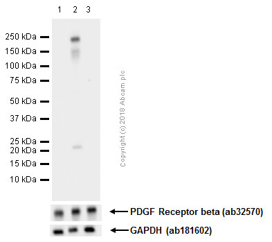 Western blot - Anti-PDGFR beta (phospho Y1021) antibody [EPR2476] (AB134048), expandable thumbnail