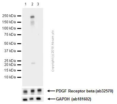 Western blot - Anti-PDGFR beta (phospho Y1021) antibody [EPR2476] (AB134048)
