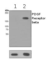Western blot - Anti-PDGFR beta (phospho Y1021) antibody [EPR2476] - BSA and Azide free (AB248657), expandable thumbnail