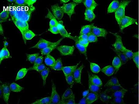 Immunocytochemistry/ Immunofluorescence - Anti-PDGFR beta (phospho Y740) antibody [SN0646] (AB326626)