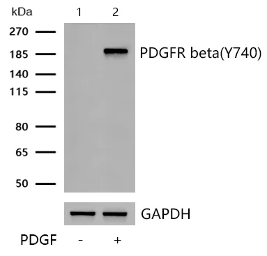 Western blot - Anti-PDGFR beta (phospho Y740) antibody [SN0646] (AB326626)