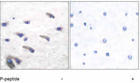 Immunohistochemistry (Formalin/PFA-fixed paraffin-embedded sections) - Anti-PDGFR beta (phospho Y751) antibody (AB51046), expandable thumbnail