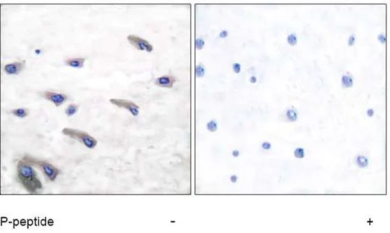 Immunohistochemistry (Formalin/PFA-fixed paraffin-embedded sections) - Anti-PDGFR beta (phospho Y751) antibody (AB51046)