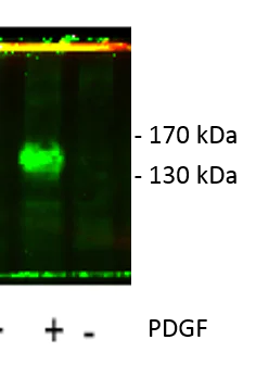 Western blot - Anti-PDGFR beta (phospho Y751) antibody (AB51046)