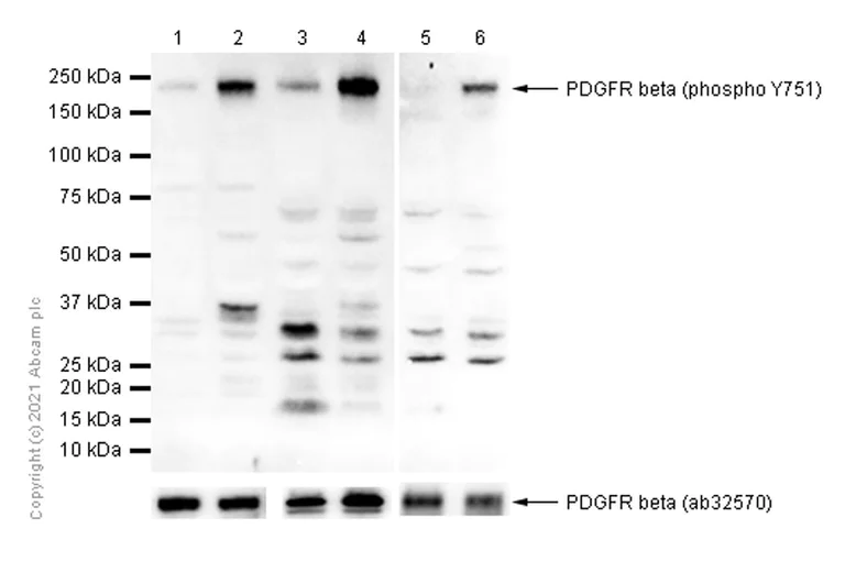Western blot - Anti-PDGFR beta (phospho Y751) antibody [EPR21744] (AB218534)
