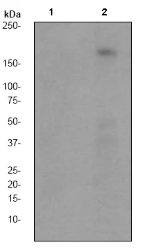 Western blot - Anti-PDGFR beta (phospho Y857) antibody [EP2136Y] (AB62367)