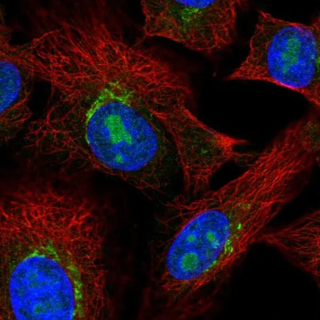 Immunocytochemistry/ Immunofluorescence - Anti-PDGFRL antibody (AB220745)
