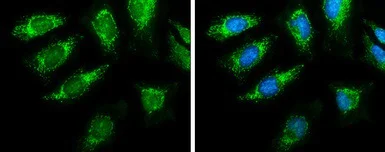 Immunocytochemistry/ Immunofluorescence - Anti-PDHA1 antibody (AB97352)