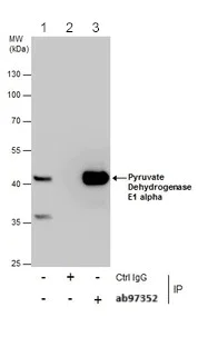 Immunoprecipitation - Anti-PDHA1 antibody (AB97352)