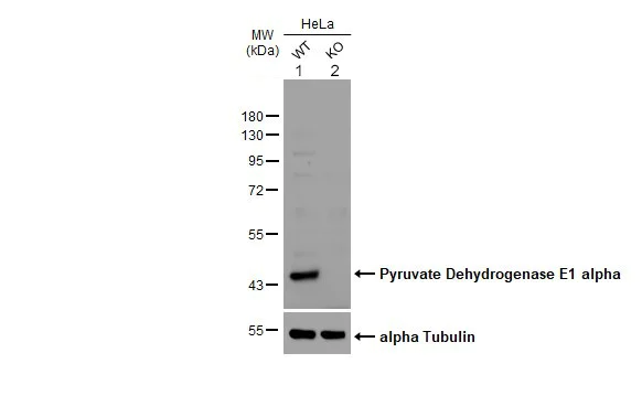 Western blot - Anti-PDHA1 antibody (AB97352)