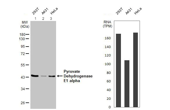 Western blot - Anti-PDHA1 antibody (AB97352)