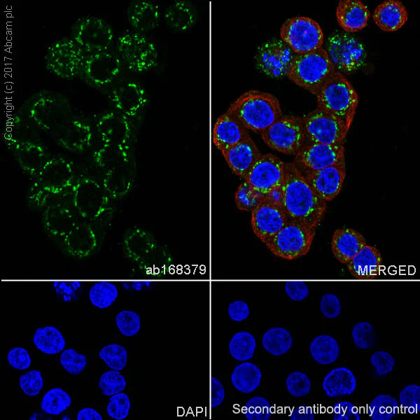 Immunohistochemistry (Formalin/PFA-fixed paraffin-embedded sections) - Anti-PDHA1 antibody [EPR11098] (AB168379)