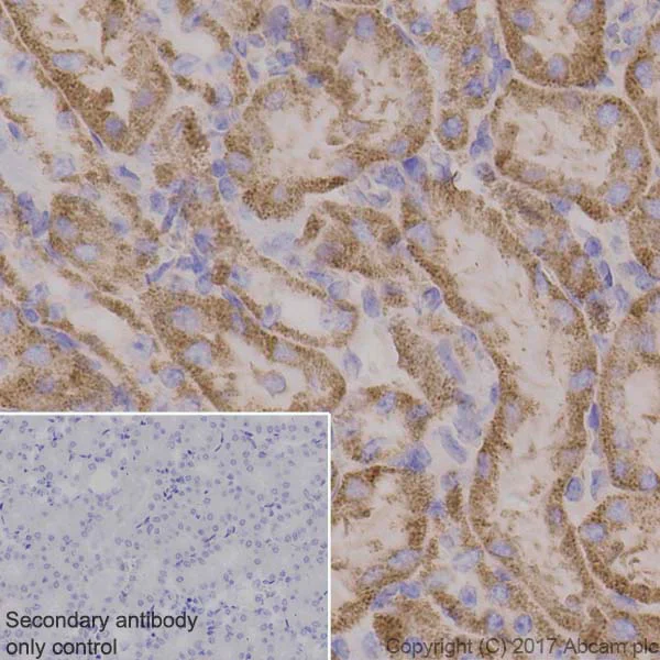 Immunohistochemistry (Formalin/PFA-fixed paraffin-embedded sections) - Anti-PDHA1 antibody [EPR11098] (AB168379)