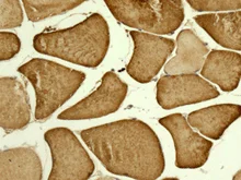 Immunohistochemistry (Formalin/PFA-fixed paraffin-embedded sections) - Anti-PDHA1 antibody [EPR11098] (AB168379)