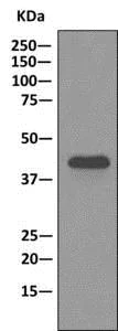 Immunoprecipitation - Anti-PDHA1 antibody [EPR11098] (AB168379)