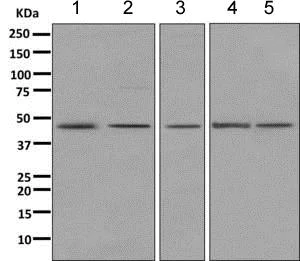 Western blot - Anti-PDHA1 antibody [EPR11098] (AB168379)