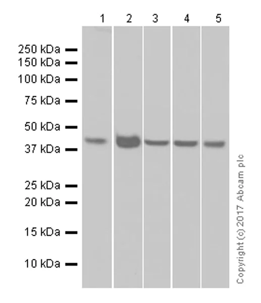 Western blot - Anti-PDHA1 antibody [EPR11098] (AB168379)