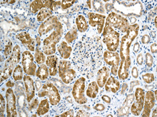 Immunohistochemistry (Formalin/PFA-fixed paraffin-embedded sections) - Anti-PDHA1 antibody [EPR11098] - BSA and Azide free (AB176835)