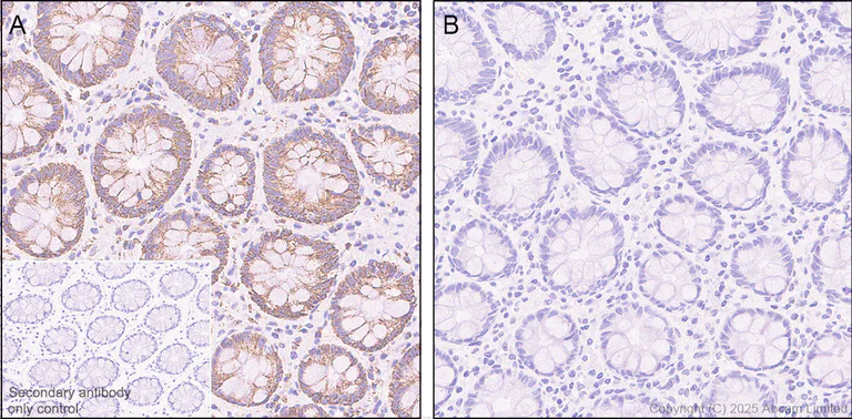 Immunohistochemistry (Formalin/PFA-fixed paraffin-embedded sections) - Anti-PDHA1 (phospho S232) antibody [EPR29825-102] (AB325169)