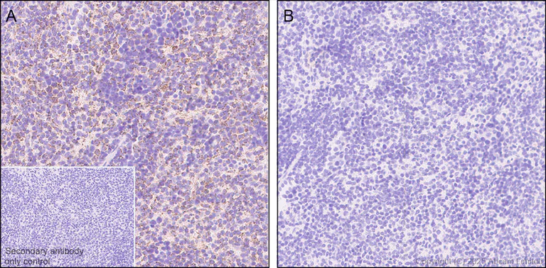 Immunohistochemistry (Formalin/PFA-fixed paraffin-embedded sections) - Anti-PDHA1 (phospho S232) antibody [EPR29825-102] (AB325169)