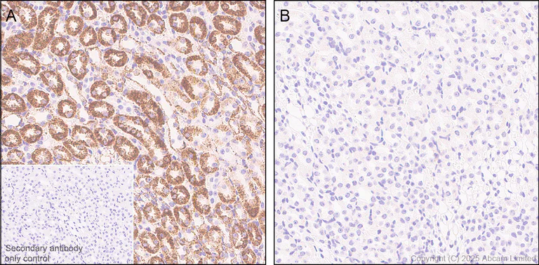 Immunohistochemistry (Formalin/PFA-fixed paraffin-embedded sections) - Anti-PDHA1 (phospho S232) antibody [EPR29825-102] (AB325169)