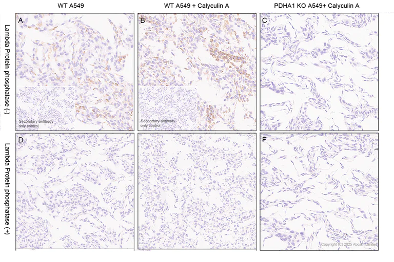 Immunohistochemistry (Formalin/PFA-fixed paraffin-embedded sections) - Anti-PDHA1 (phospho S232) antibody [EPR29825-102] (AB325169)