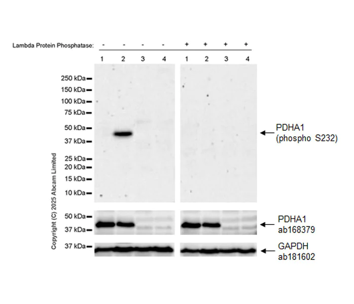 Western blot - Anti-PDHA1 (phospho S232) antibody [EPR29825-102] (AB325169)