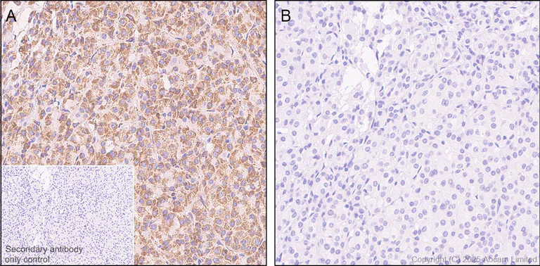 Immunohistochemistry (Formalin/PFA-fixed paraffin-embedded sections) - Anti-PDHA1 (phospho S232) antibody [EPR29825-102] – BSA and Azide free (AB325184)