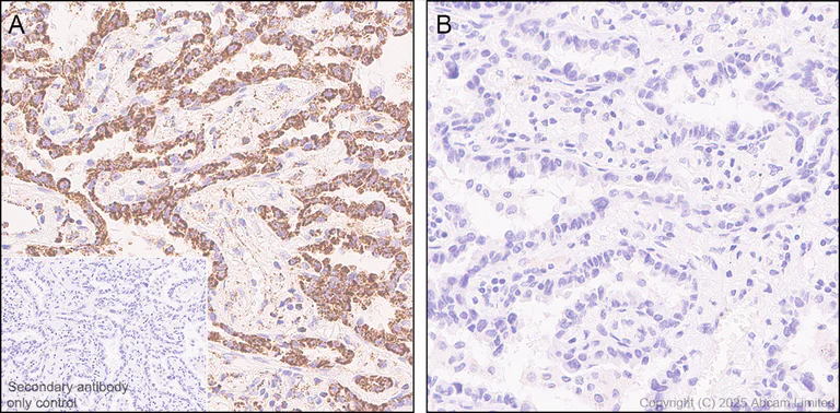 Immunohistochemistry (Formalin/PFA-fixed paraffin-embedded sections) - Anti-PDHA1 (phospho S232) antibody [EPR29825-102] – BSA and Azide free (AB325184)