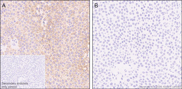 Immunohistochemistry (Formalin/PFA-fixed paraffin-embedded sections) - Anti-PDHA1 (phospho S232) antibody [EPR29825-102] – BSA and Azide free (AB325184)