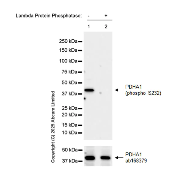 Western blot - Anti-PDHA1 (phospho S232) antibody [EPR29825-102] – BSA and Azide free (AB325184)