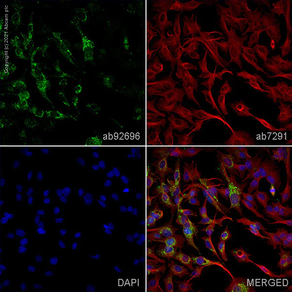 Immunocytochemistry/ Immunofluorescence - Anti-PDHA1 (phospho S293) antibody (AB92696)