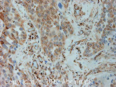 Immunohistochemistry (Formalin/PFA-fixed paraffin-embedded sections) - Anti-PDHA1 (phospho S293) antibody (AB92696)