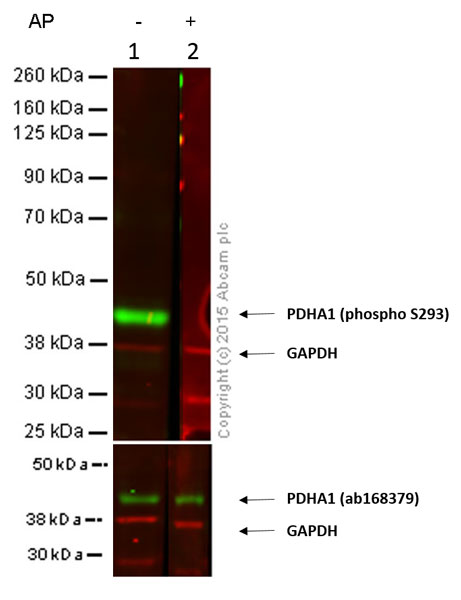 Western blot - Anti-PDHA1 (phospho S293) antibody (AB92696)