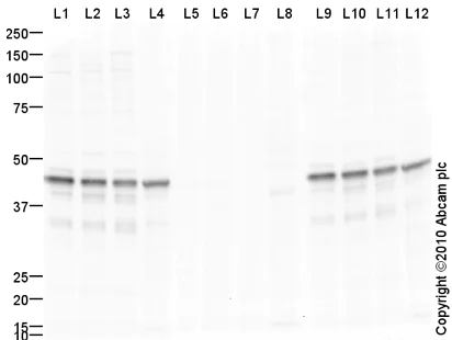 Western blot - Anti-PDHA1 (phospho S293) antibody (AB92696)