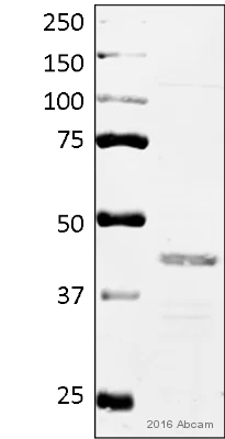 Western blot - Anti-PDHA1 (phospho S293) antibody (AB92696)