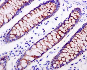 Immunohistochemistry (Formalin/PFA-fixed paraffin-embedded sections) - Anti-PDHA1 (phospho S293) antibody [EPR12200] (AB177461)