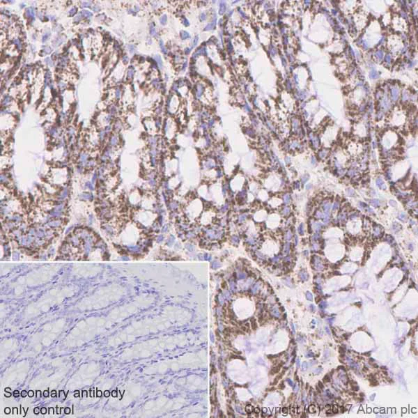 Immunohistochemistry (Formalin/PFA-fixed paraffin-embedded sections) - Anti-PDHA1 (phospho S293) antibody [EPR12200] (AB177461)