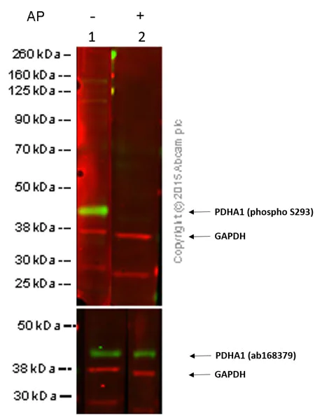 Western blot - Anti-PDHA1 (phospho S293) antibody [EPR12200] (AB177461)