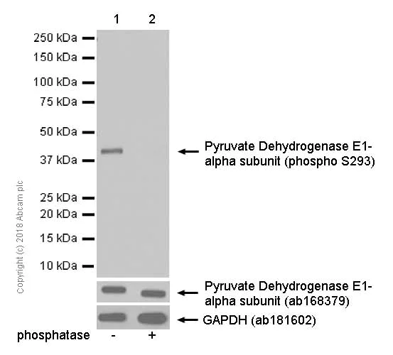 Western blot - Anti-PDHA1 (phospho S293) antibody [EPR12200] (AB177461)