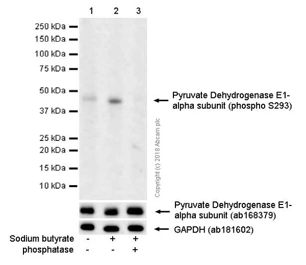 Western blot - Anti-PDHA1 (phospho S293) antibody [EPR12200] (AB177461)