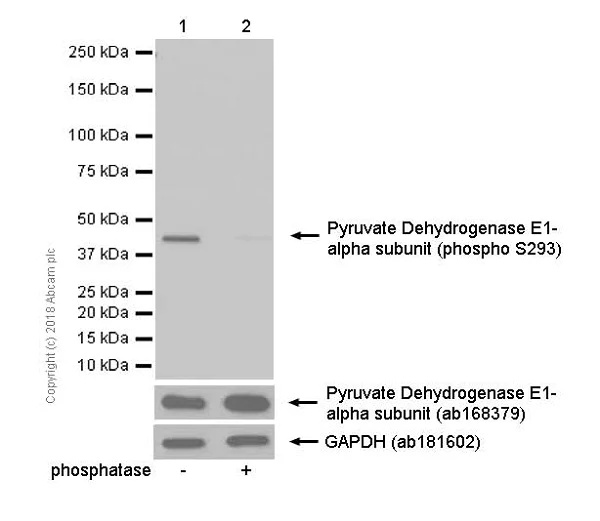 Western blot - Anti-PDHA1 (phospho S293) antibody [EPR12200] (AB177461)